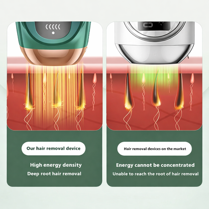 IPL Freezing Point Strong Pulse Hair Removal Device